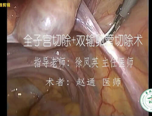 Laparoscopic hysterectomy performed with ultrasound