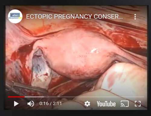 Conservative management of ectopic pregnancy