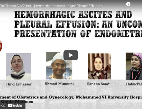 Hemorrhagic ascites and pleural effusion: an uncommon presentation of endometriosis
