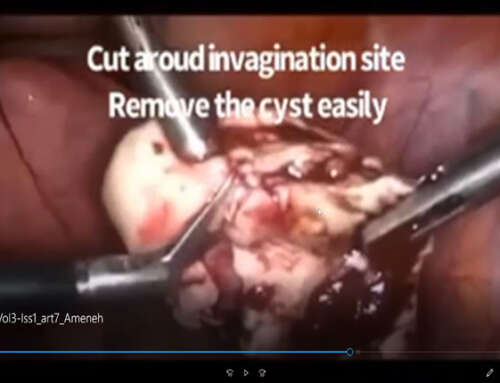 Increasing trend of serum antimüullerian hormone level after long term follow up of endometrioma resection