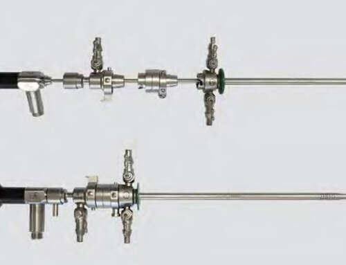 Awake Hysteroscopy with Kruschinski Modular Scope (KMS)